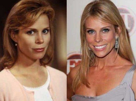 Cheryl Hines Plastic Surgery Before After