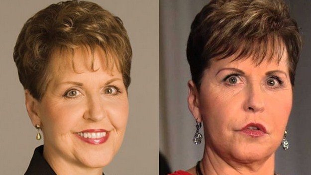Joyce Meyer Plastic Surgery Before After
