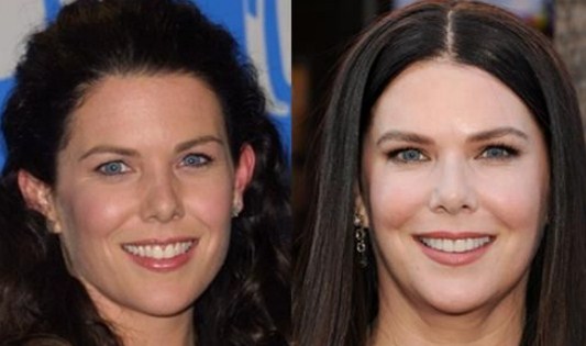 Lauren Graham Plastic Surgery Before After