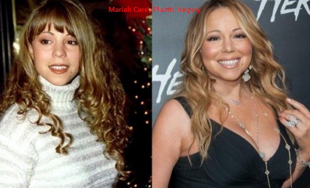 Mariah Carey Plastic Surgery