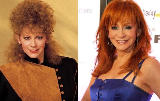 Reba Mcentire Plastic Surgery Before After