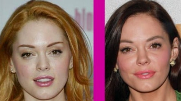 Rose McGowan Plastic Surgery Before After