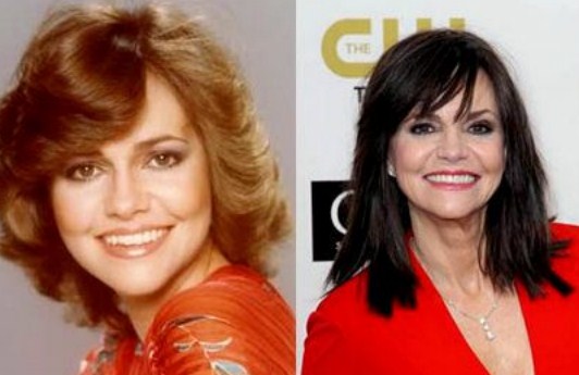 Sally Field Plastic Surgery Before After