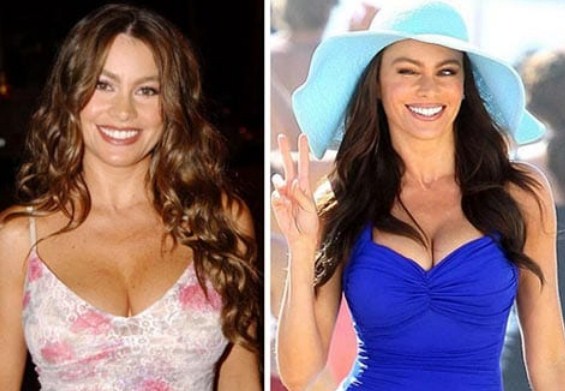 Sofia Vergara Plastic Surgery Before After