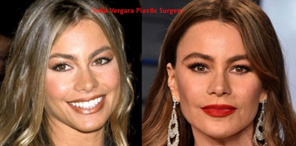 Sofia Vergara Plastic Surgery