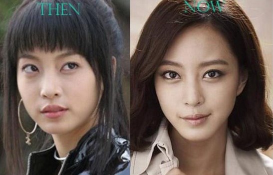 Han Ye Seul Plastic Surgery Transformation