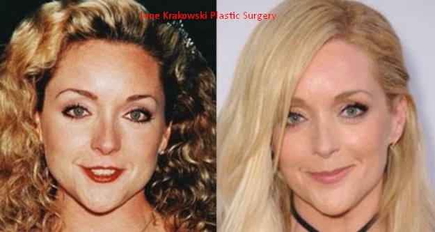 Jane Krakowski Plastic Surgery