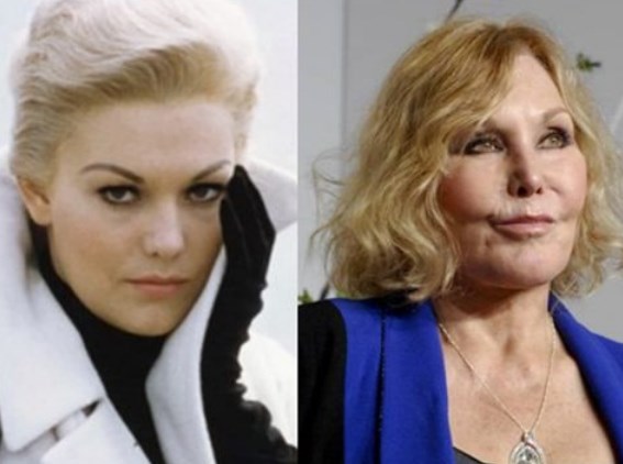 Kim Novak Plastic Surgery Before After