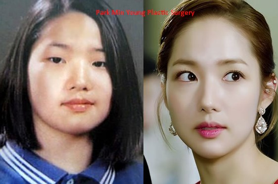 Park Min Young Plastic Surgery Transformation