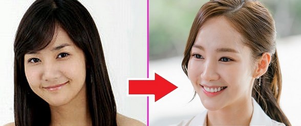 Park Min Young Plastic Surgery