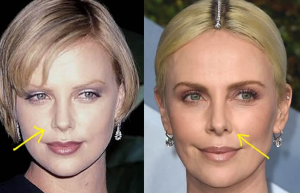 Charlize Theron Nose Job