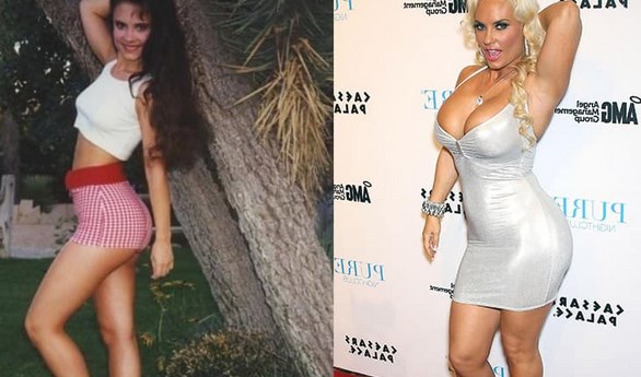 Coco Austin Plastic Surgery Before After