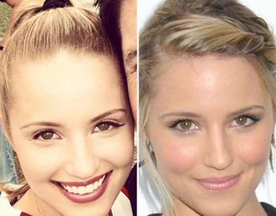 Dianna Agron Nose Job