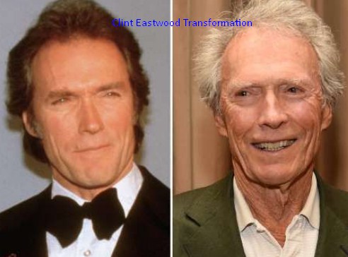 Clint Eastwood Plastic Surgery