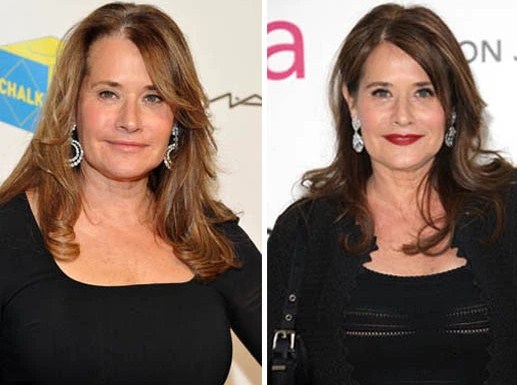 Lorraine Bracco Plastic Surgery