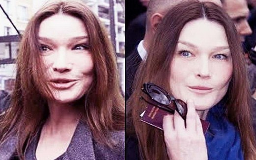 Carla Bruni Plastic Surgery