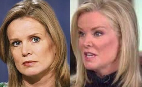 Katty Kay Plastic Surgery