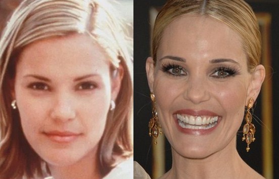 Leslie Bibb Plastic Surgery