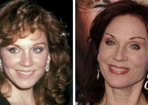 Marilu Henner Plastic Surgery