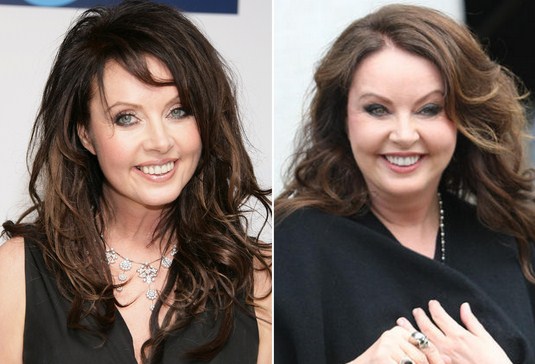 Sarah Brightman Plastic Surgery