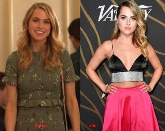 Anne Winters Weight Loss Before After