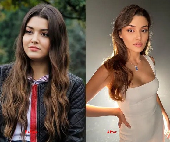 Hande Ercel Weight Loss