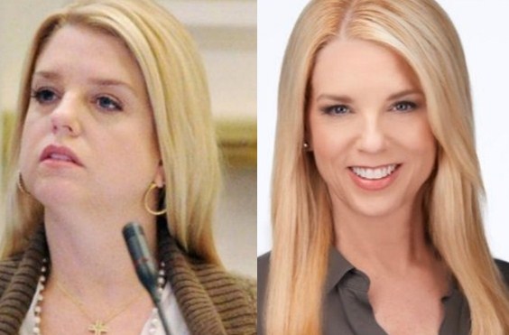 Pam Bondi Weight Loss Before After