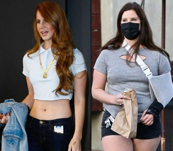 Lana Del Rey Weight Gain Before and After