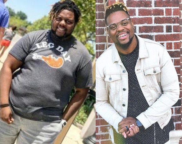 Osby Berry Weight Loss Surgery