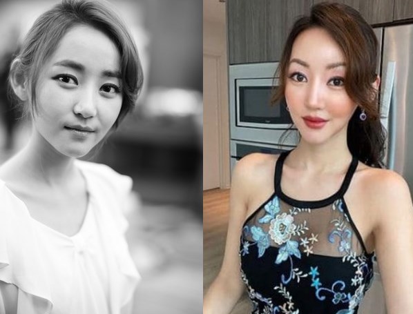 Yeonmi Park Plastic Surgery Before After